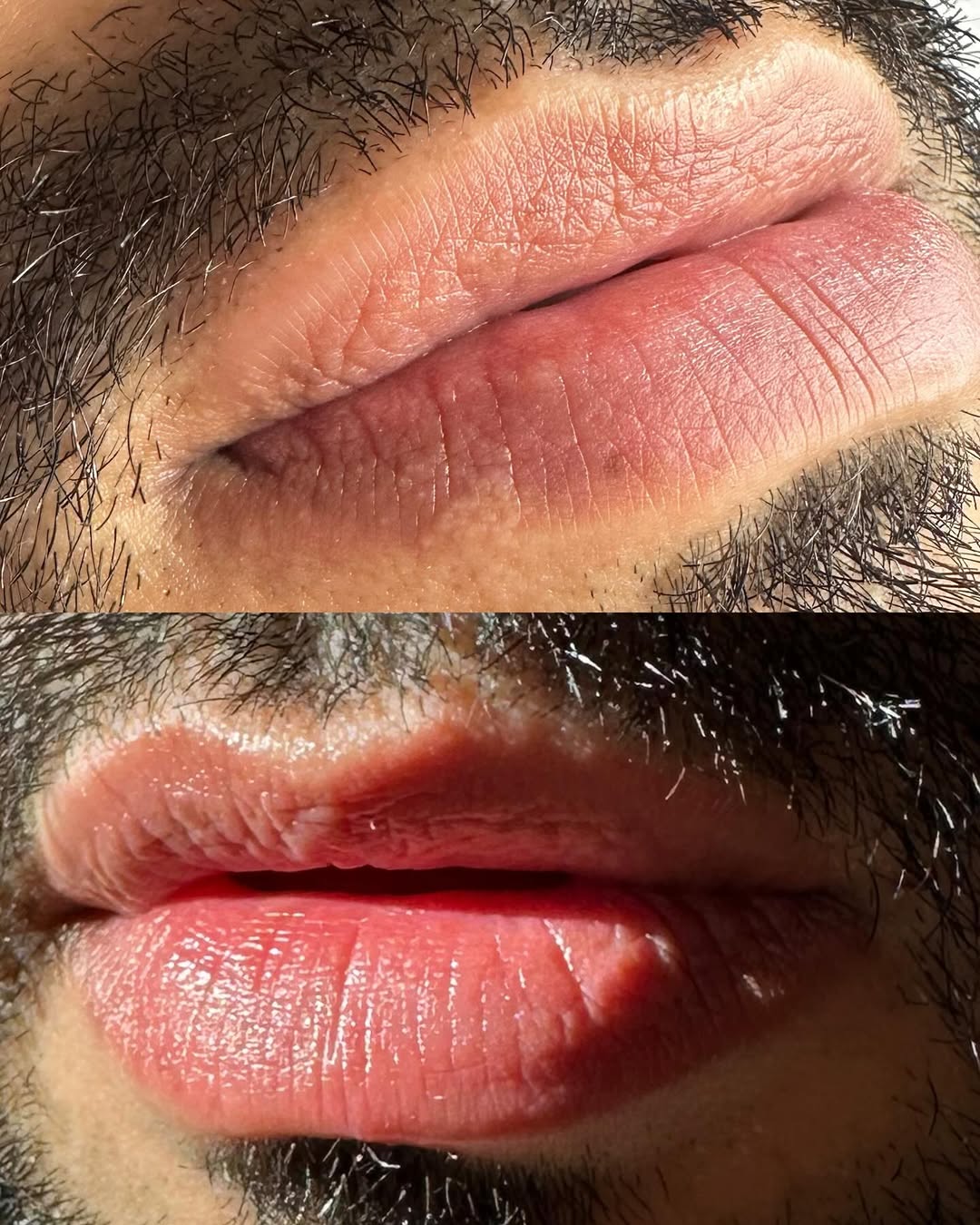 Lip Color Enhancement